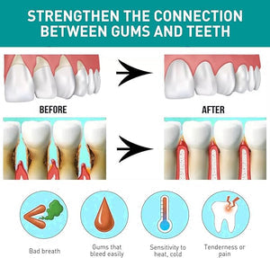 Eelhoe - Mouth Relief Spray